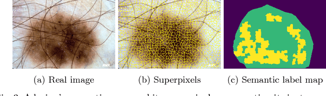 Figure 4 for Skin Lesion Synthesis with Generative Adversarial Networks