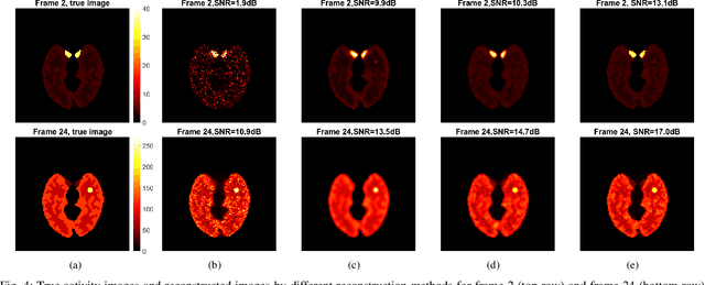 Figure 4 for Deep Kernel Representation for Image Reconstruction in PET