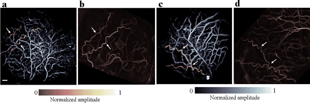 Figure 1 for Transcranial photoacoustic computed tomography of human brain function