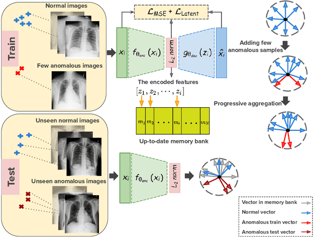 Figure 1 for Anomaly Detection on X-Rays Using Self-Supervised Aggregation Learning