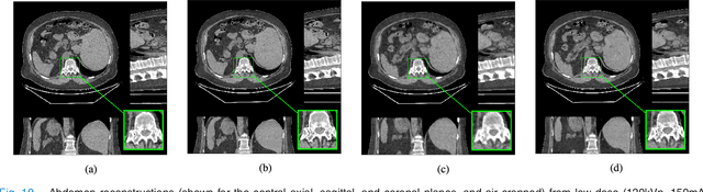Figure 2 for PWLS-ULTRA: An Efficient Clustering and Learning-Based Approach for Low-Dose 3D CT Image Reconstruction