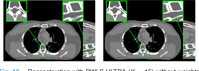 Figure 4 for PWLS-ULTRA: An Efficient Clustering and Learning-Based Approach for Low-Dose 3D CT Image Reconstruction