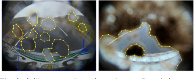 Figure 2 for Pseudo-Label Ensemble-based Semi-supervised Learning for Handling Noisy Soiling Segmentation Annotations