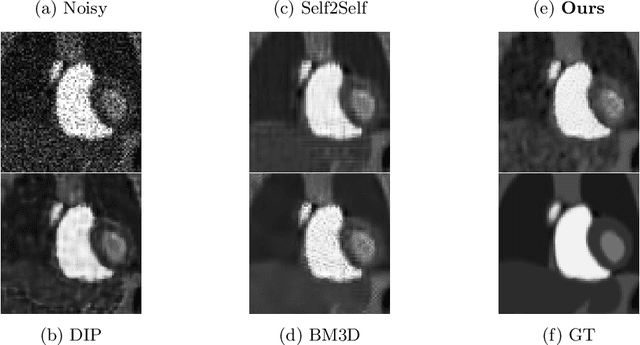 Figure 2 for Poisson2Sparse: Self-Supervised Poisson Denoising From a Single Image