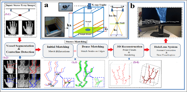 Figure 2 for Virtual Blood Vessels in Complex Background using Stereo X-ray Images