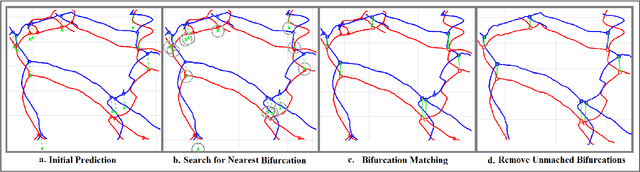 Figure 4 for Virtual Blood Vessels in Complex Background using Stereo X-ray Images