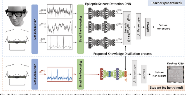 Figure 3 for Many-to-One Knowledge Distillation of Real-Time Epileptic Seizure Detection for Low-Power Wearable Internet of Things Systems