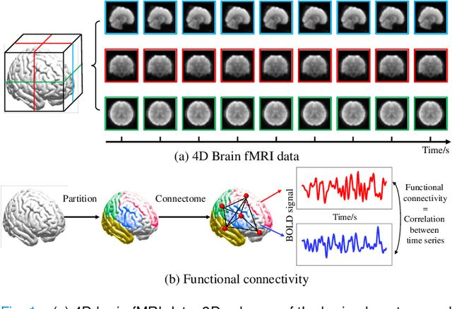 Figure 1 for BrainFormer: A Hybrid CNN-Transformer Model for Brain fMRI Data Classification