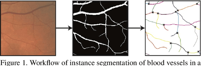 Figure 1 for Deep Semantic Instance Segmentation of Tree-like Structures Using Synthetic Data