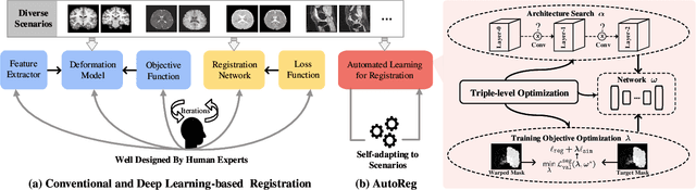 Figure 1 for Automated Learning for Deformable Medical Image Registration by Jointly Optimizing Network Architectures and Objective Functions