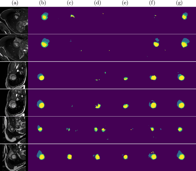 Figure 3 for Semi-Supervised and Task-Driven Data Augmentation