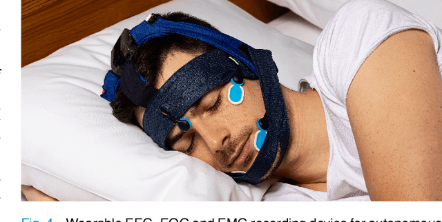 Figure 4 for Benchmarking real-time algorithms for in-phase auditory stimulation of low amplitude slow waves with wearable EEG devices during sleep