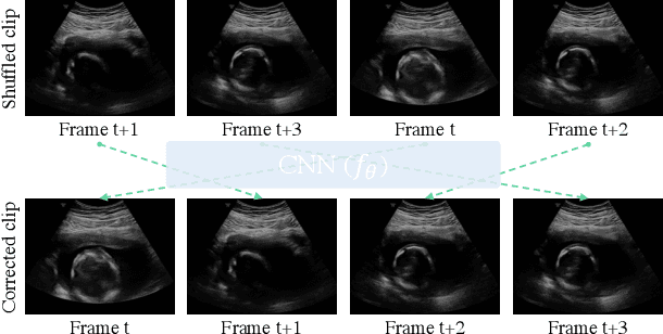Figure 1 for Self-supervised Representation Learning for Ultrasound Video