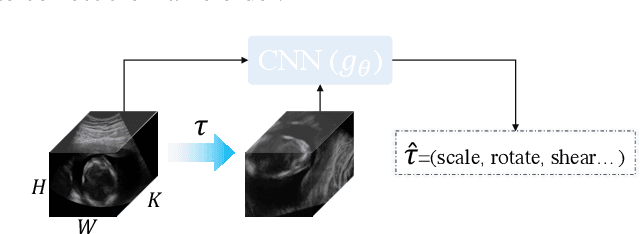 Figure 3 for Self-supervised Representation Learning for Ultrasound Video
