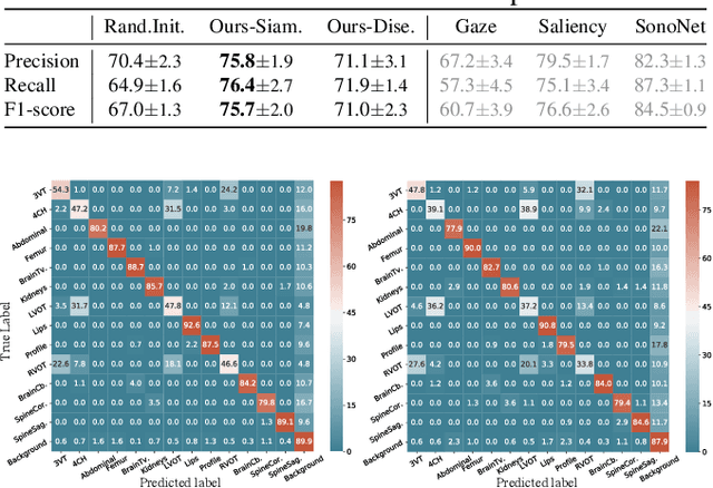 Figure 2 for Self-supervised Representation Learning for Ultrasound Video