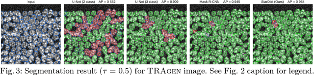 Figure 4 for Cell Detection with Star-convex Polygons