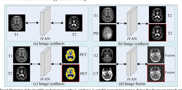 Figure 2 for Variable Augmented Network for Invertible Modality Synthesis-Fusion