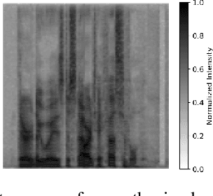 Figure 1 for Synthesized Speech Detection Using Convolutional Transformer-Based Spectrogram Analysis