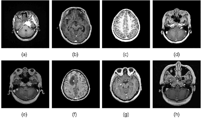 Figure 1 for Brain Tumors Classification for MR images based on Attention Guided Deep Learning Model