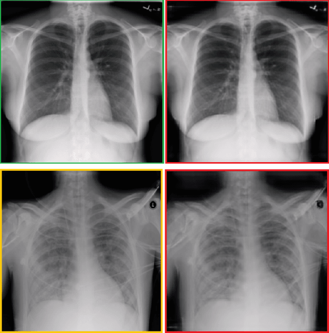 Figure 1 for Synthesis of COVID-19 Chest X-rays using Unpaired Image-to-Image Translation