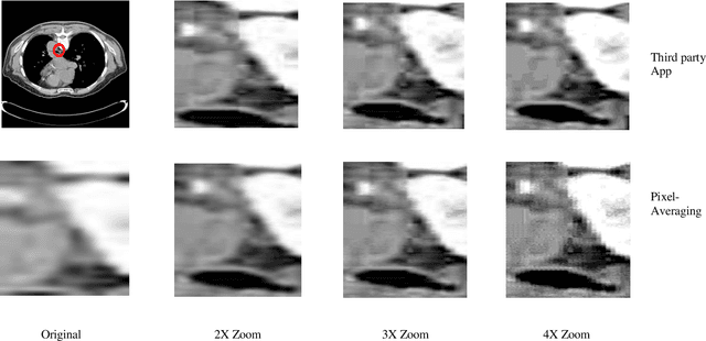 Figure 4 for A Novel Pixel-Averaging Technique for Extracting Training Data from a Single Image, Used in ML-Based Image Enlargement