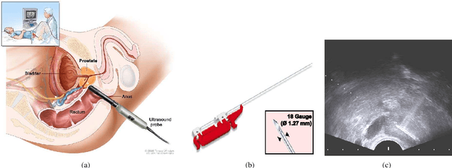 Figure 1 for Prostate biopsy tracking with deformation estimation