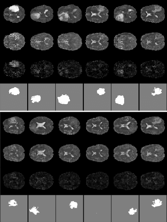Figure 2 for Improved Slice-wise Tumour Detection in Brain MRIs by Computing Dissimilarities between Latent Representations
