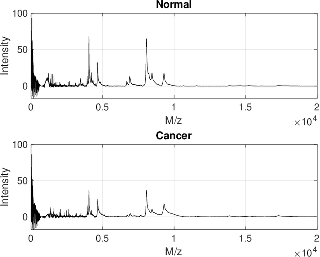 Figure 1 for Early Detection of Ovarian Cancer by Wavelet Analysis of Protein Mass Spectra