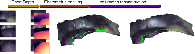 Figure 2 for Endo-Depth-and-Motion: Localization and Reconstruction in Endoscopic Videos using Depth Networks and Photometric Constraints