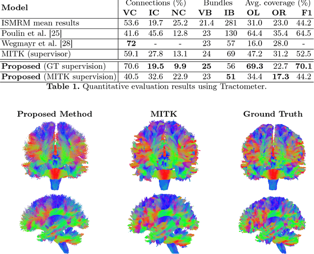 Figure 2 for DeepTract: A Probabilistic Deep Learning Framework for White Matter Fiber Tractography