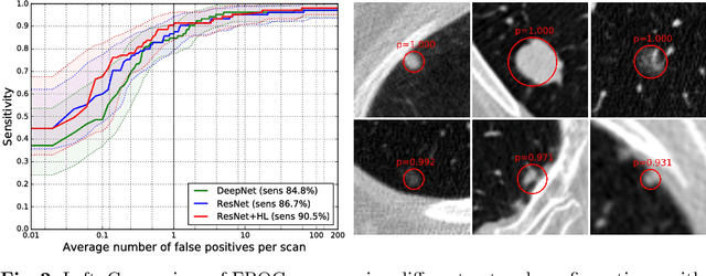 Figure 3 for Automated Pulmonary Nodule Detection via 3D ConvNets with Online Sample Filtering and Hybrid-Loss Residual Learning