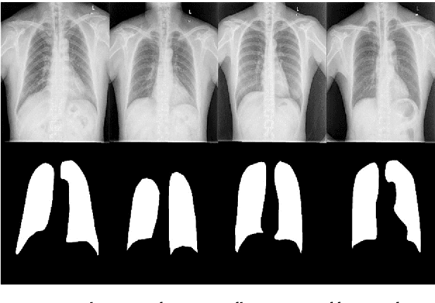 Figure 1 for Segmentation of Lungs in Chest X-Ray Image Using Generative Adversarial Networks