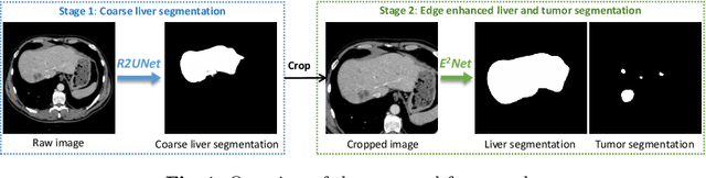 Figure 1 for E$^2$Net: An Edge Enhanced Network for Accurate Liver and Tumor Segmentation on CT Scans