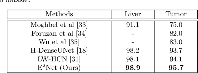 Figure 4 for E$^2$Net: An Edge Enhanced Network for Accurate Liver and Tumor Segmentation on CT Scans