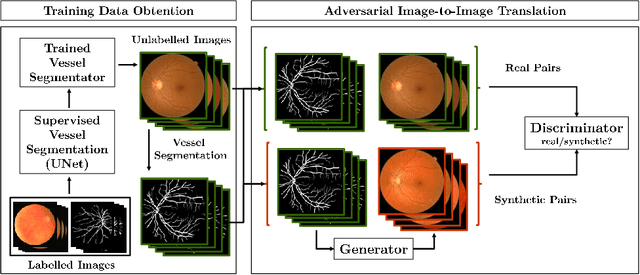 Figure 1 for Towards Adversarial Retinal Image Synthesis