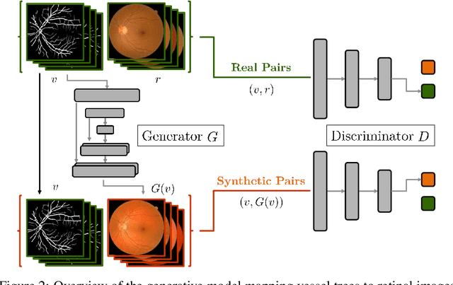 Figure 3 for Towards Adversarial Retinal Image Synthesis