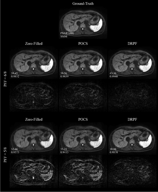 Figure 3 for Robust partial Fourier reconstruction for diffusion-weighted imaging using a recurrent convolutional neural network