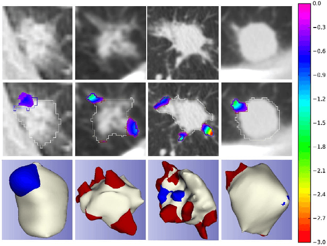 Figure 1 for CIRDataset: A large-scale Dataset for Clinically-Interpretable lung nodule Radiomics and malignancy prediction