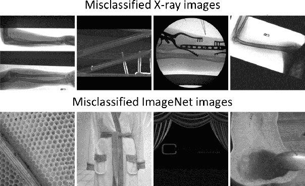 Figure 2 for End-to-End Deep Diagnosis of X-ray Images