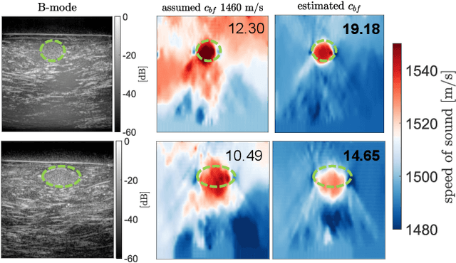 Figure 4 for Estimating Mean Speed-of-Sound from Sequence-Dependent Geometric Disparities