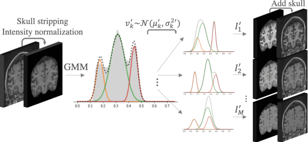 Figure 1 for An augmentation strategy to mimic multi-scanner variability in MRI