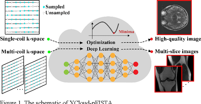 Figure 1 for XCloud-pFISTA: A Medical Intelligence Cloud for Accelerated MRI