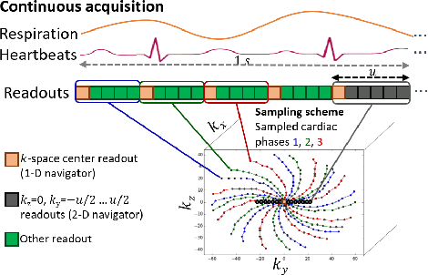 Figure 1 for 2-D Respiration Navigation Framework for 3-D Continuous Cardiac Magnetic Resonance Imaging