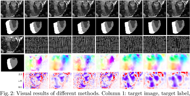 Figure 4 for Nesterov Accelerated ADMM for Fast Diffeomorphic Image Registration
