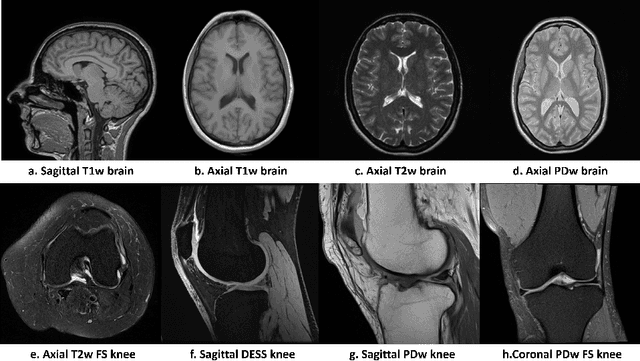 Figure 1 for Undersampled MRI Reconstruction with Side Information-Guided Normalisation