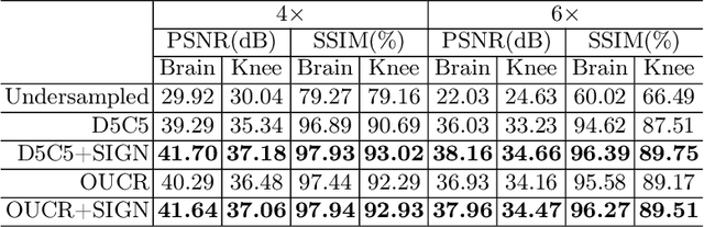 Figure 2 for Undersampled MRI Reconstruction with Side Information-Guided Normalisation