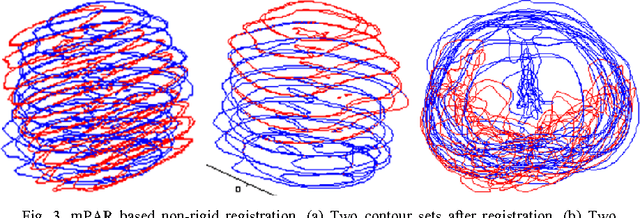 Figure 3 for A feasible roadmap for developing volumetric probability atlas of localized prostate cancer