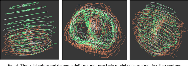 Figure 4 for A feasible roadmap for developing volumetric probability atlas of localized prostate cancer