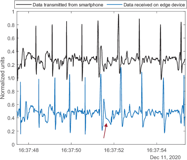 Figure 2 for Edge computing in 5G cellular networks for real-time analysis of electrocardiography recorded with wearable textile sensors