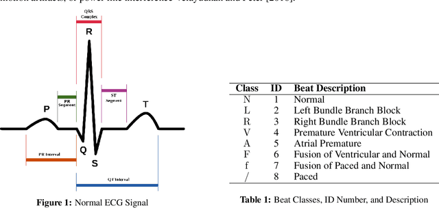 Figure 1 for Development of Interpretable Machine Learning Models to Detect Arrhythmia based on ECG Data